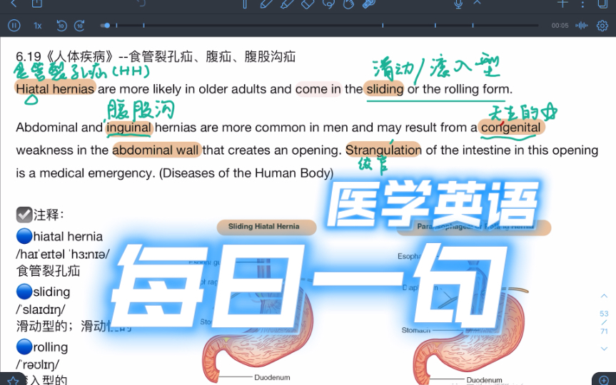 【医学英语每日一句】hernias 疝哔哩哔哩bilibili