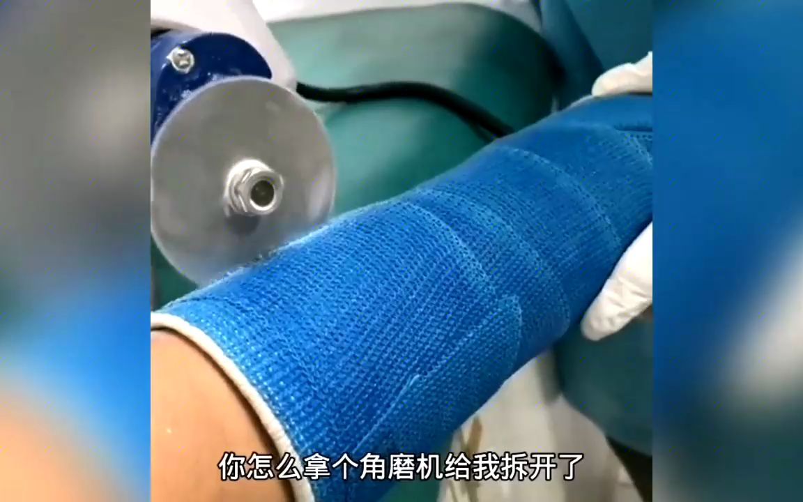 这样拆石膏你害怕吗?