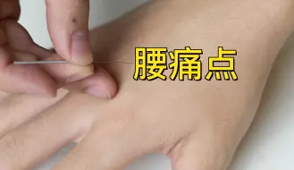 Video herunterladen: 腰痛点，腰痛穴，急性腰扭伤，腰痛。