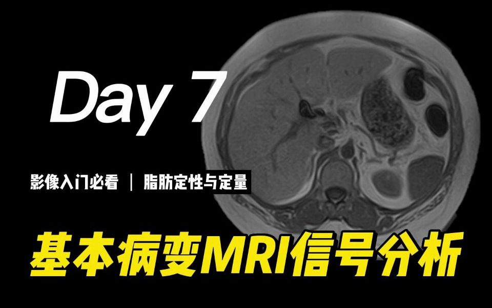 基本病变MRI信号分析:脂肪定性与定量 | 磁共振成像、脂肪肝、医学影像、脂肪抑制技术、肝脏脂肪定量、放射科哔哩哔哩bilibili