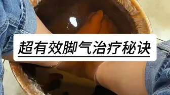 Download Video: 超有效脚气治疗秘诀，让你重获健康双脚！