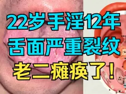 Download Video: 22岁小伙子，手淫12年，舌面严重裂纹，神仙都难救！！