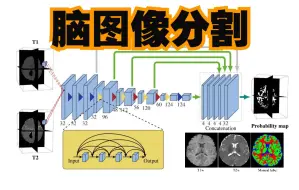 Download Video: Pytorch实战教程 | 医学图像分割 | 婴幼儿脑图像