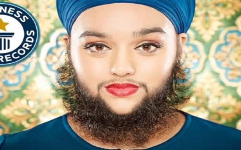 世界上胡子最长的女人,曾经想结束生命,如今觉得胡子很性感!