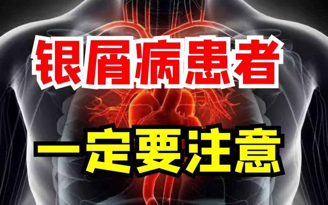 [图]心血管疾病竟然离银屑病患者这么近，咱们可一定要当心！