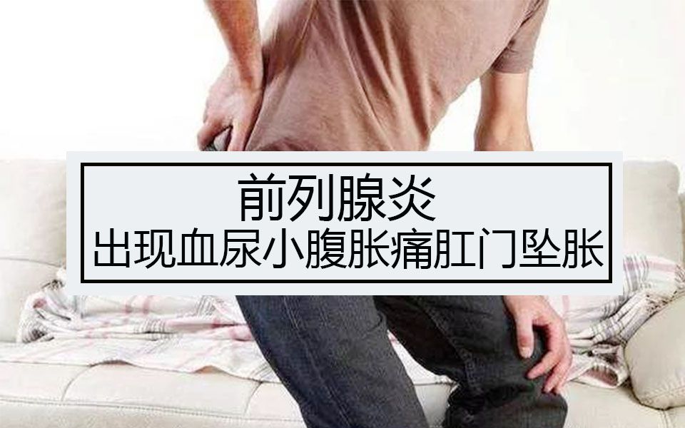 前列腺炎出现了血尿小腹胀痛肛门坠胀怎么治疗