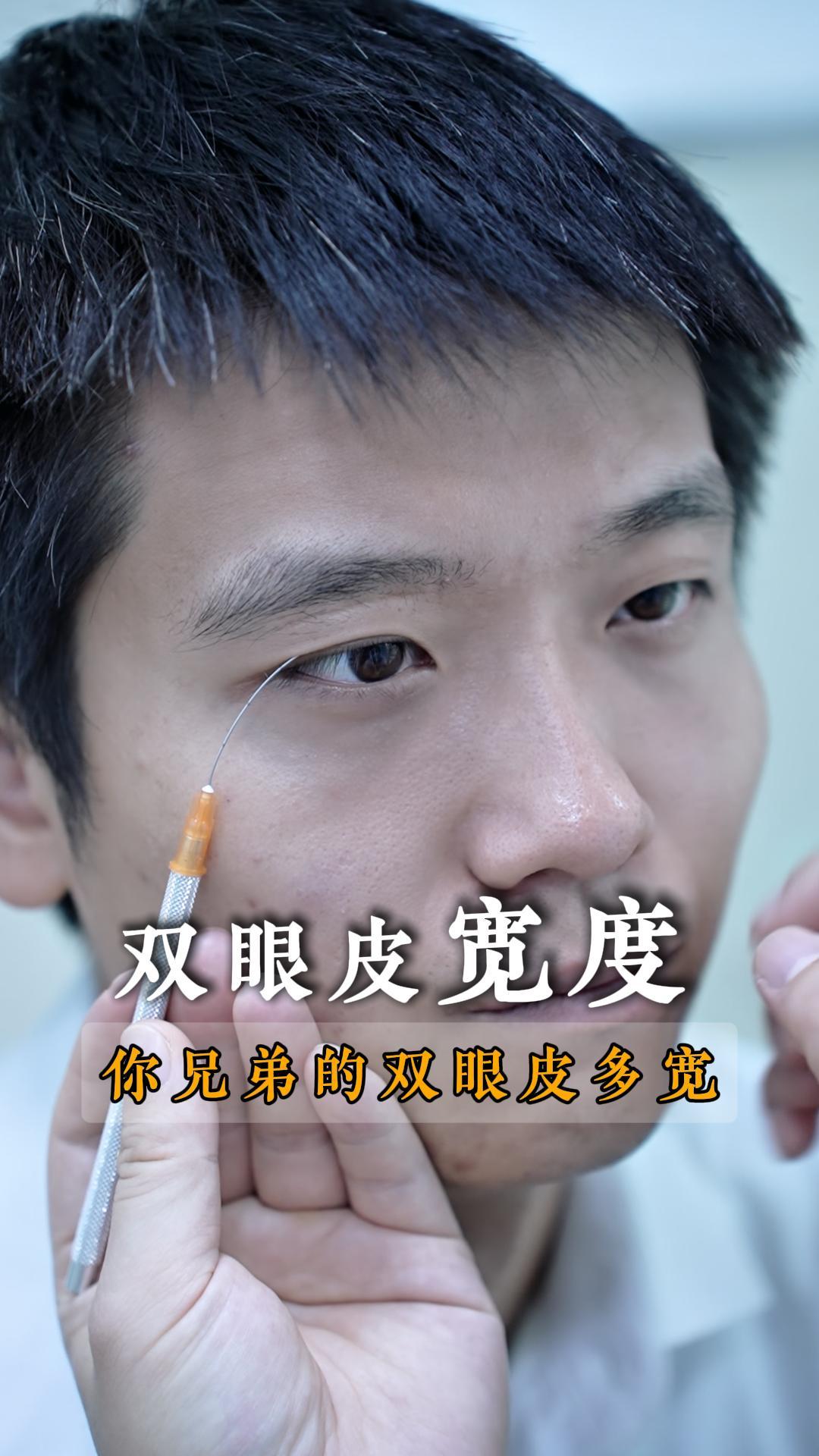 喊你兄弟来对比看下他的双眼皮是几毫米宽的?