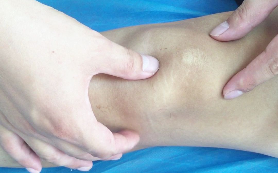 膝关节研磨试验图片