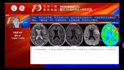 [图]自学～3D—ASL10年神经影像学习视频