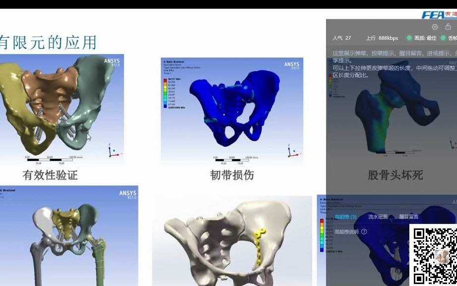 [图]ABAQUS-生物力学有限元分析流程讲解（1）