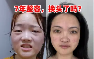 女娲没给我美貌，自己花钱“刀”一个！