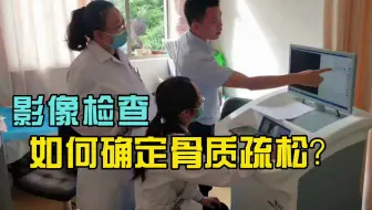 影像检查如何确定骨质疏松？艾克瑞双能X射线骨密度仪来帮您！