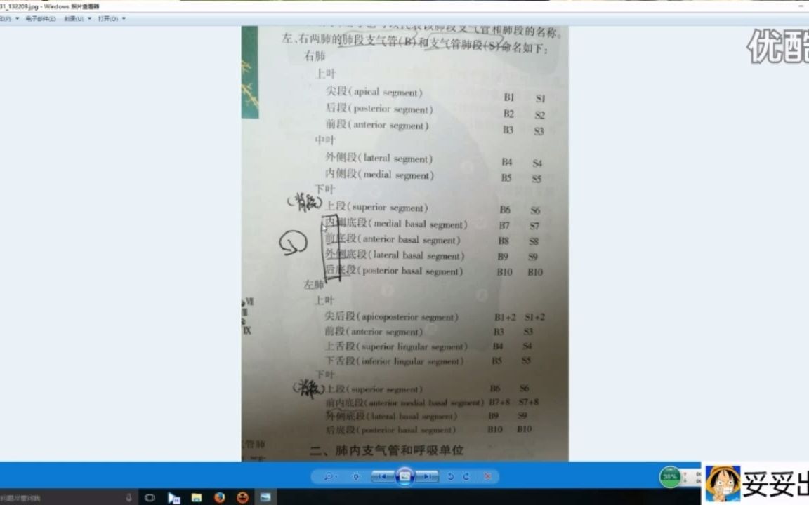 胸部CT读片系列——转载于赵妥妥老师哔哩哔哩bilibili