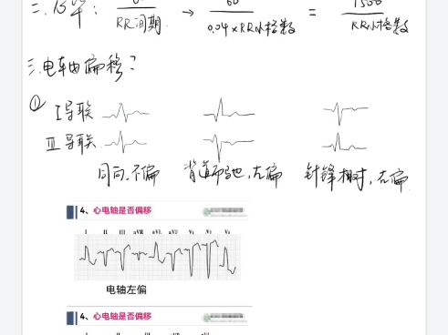 [图]二十分钟速通心电图！