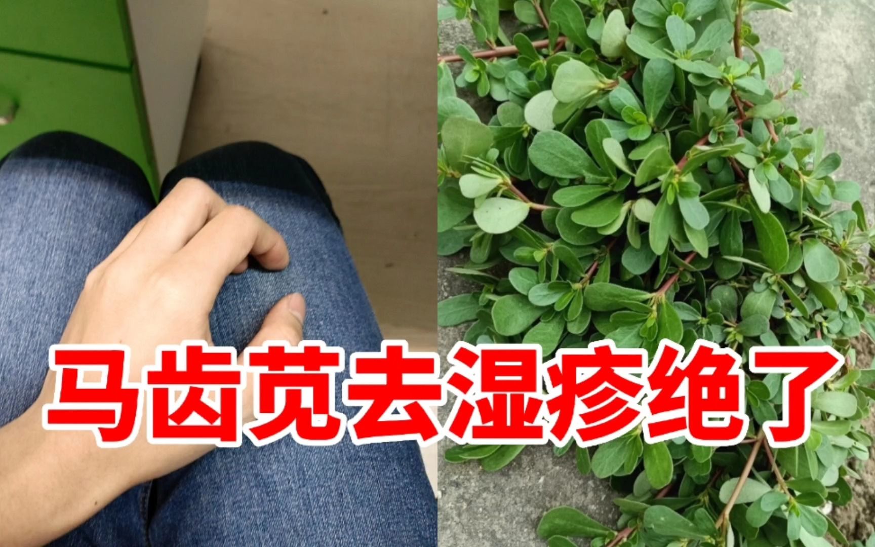 马齿苋治疗皮肤病图片