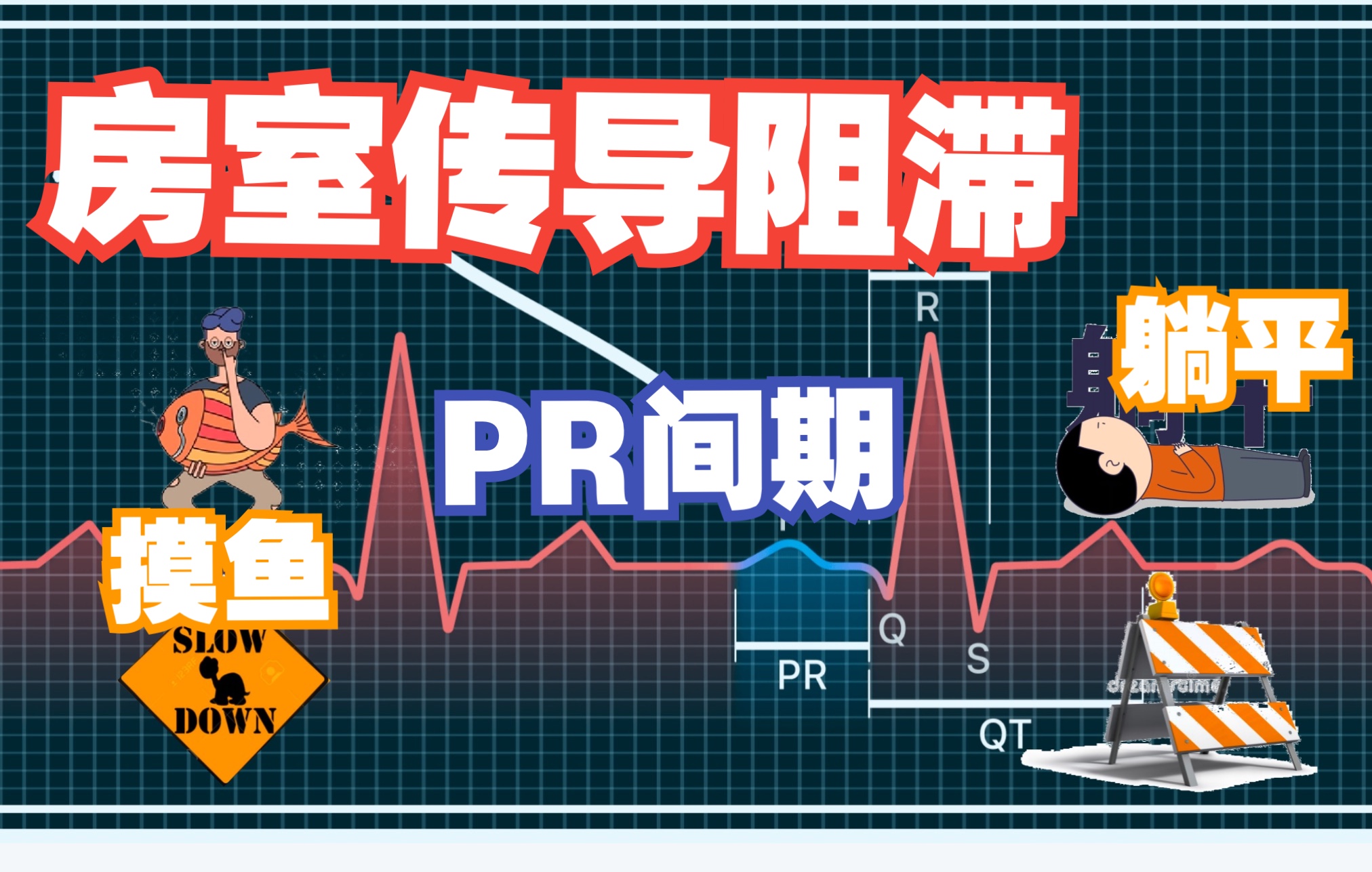 [图]最强读心术-心电图解读part2:PR间期-房室传导阻滞---持续摸鱼间断躺平（暴虐带教老师系列）人生如图，起起伏伏；生命如电，无常变幻