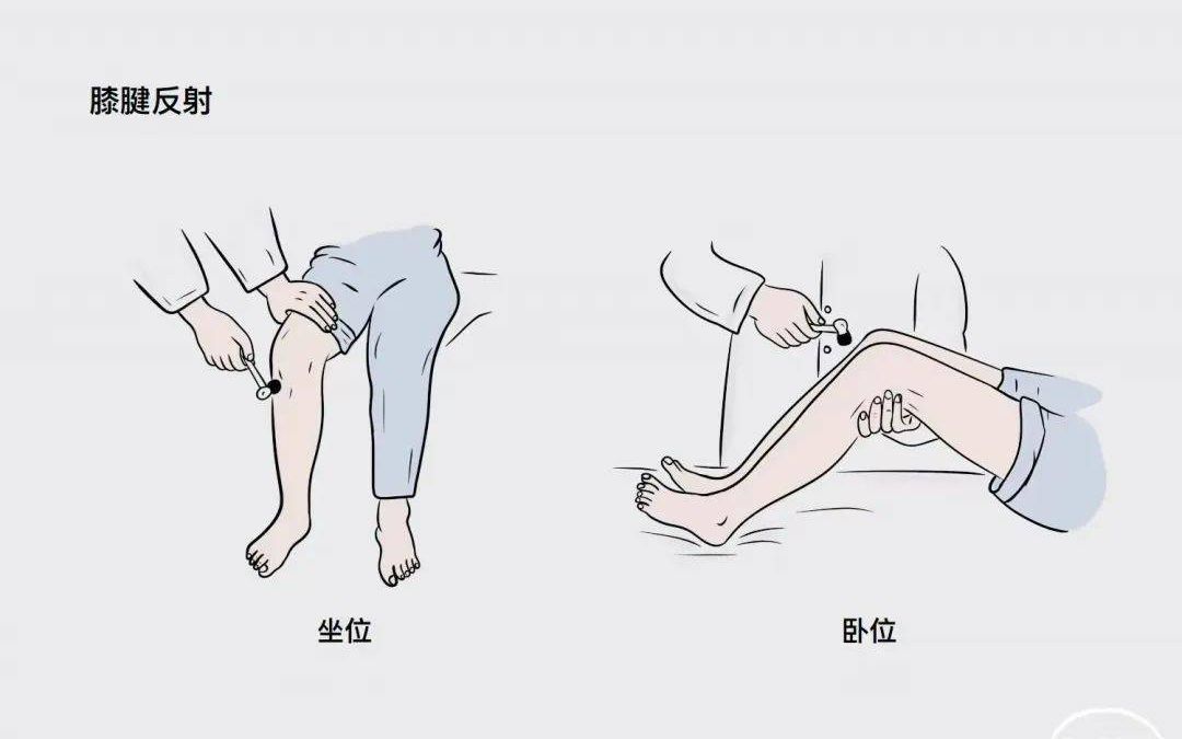 [图]神经专科查体