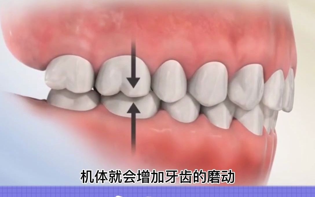 [图]为什么睡觉会磨牙？原因在这里