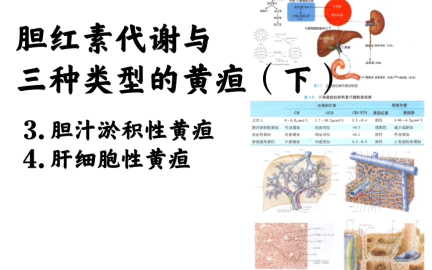 胆红素代谢与3种常见类型的黄疸(下)胆汁淤积性黄疸、肝细胞性黄疸哔哩哔哩bilibili