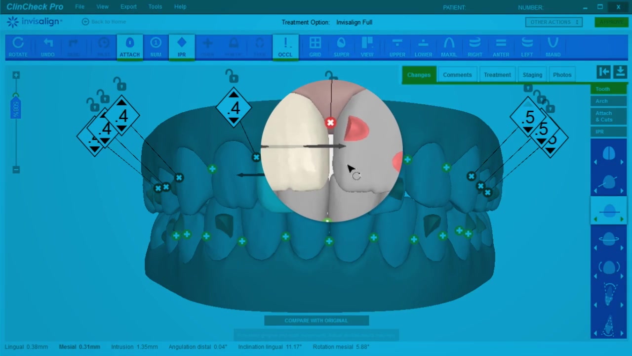 6 a-p midline adjustments