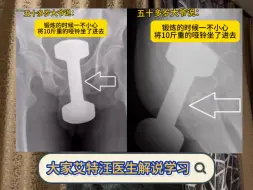 下载视频: 大家艾特汪医生解说