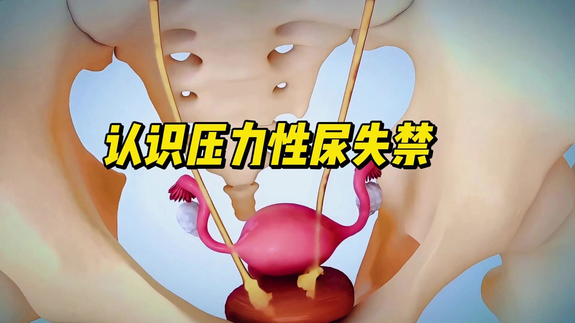 认识压力性尿失禁