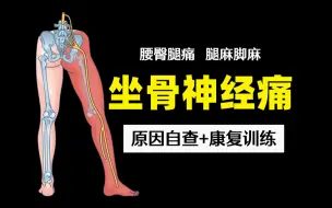 Download Video: 3分钟根源处理坐骨神经痛！原因自查+康复训练（改善腰臀腿痛/腿麻脚麻）