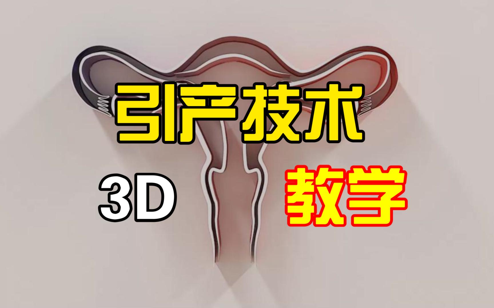 引产技术3D教学哔哩哔哩bilibili