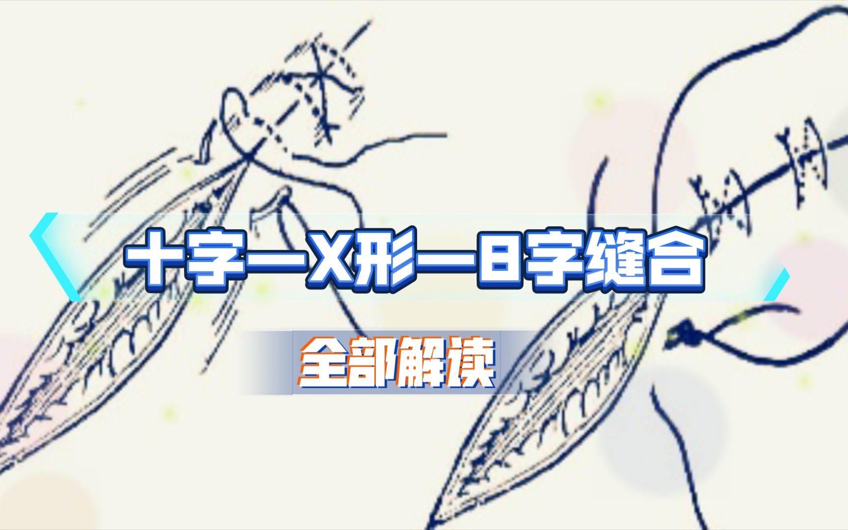 【外科手术缝合】十字缝合,x形缝合,8字缝合,你分清楚了吗?