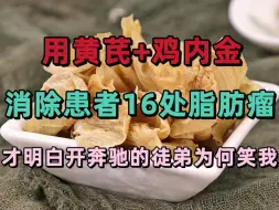 Download Video: 用黄芪+鸡内金消掉患者16处脂肪瘤，才明白开奔驰的徒弟为何笑我