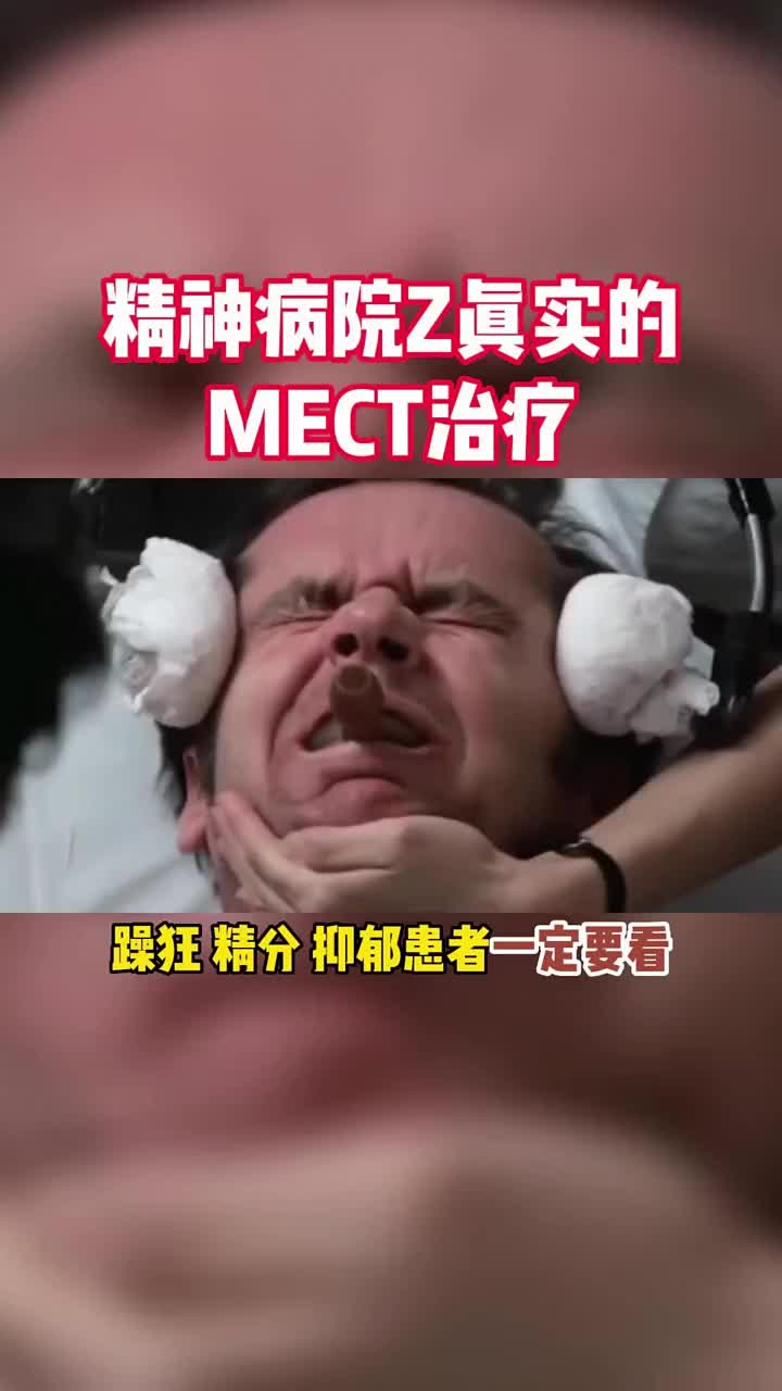 精神病院z真实的mect治疗,贵阳家长必看