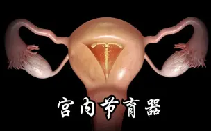 Tải video: 3D演示：宫内节育器的工作原理