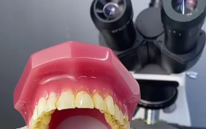 牙垢放大 科普 显微镜大世界小宇.