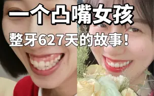 Download Video: 骨性凸嘴！整牙627天！从这样变成这样～