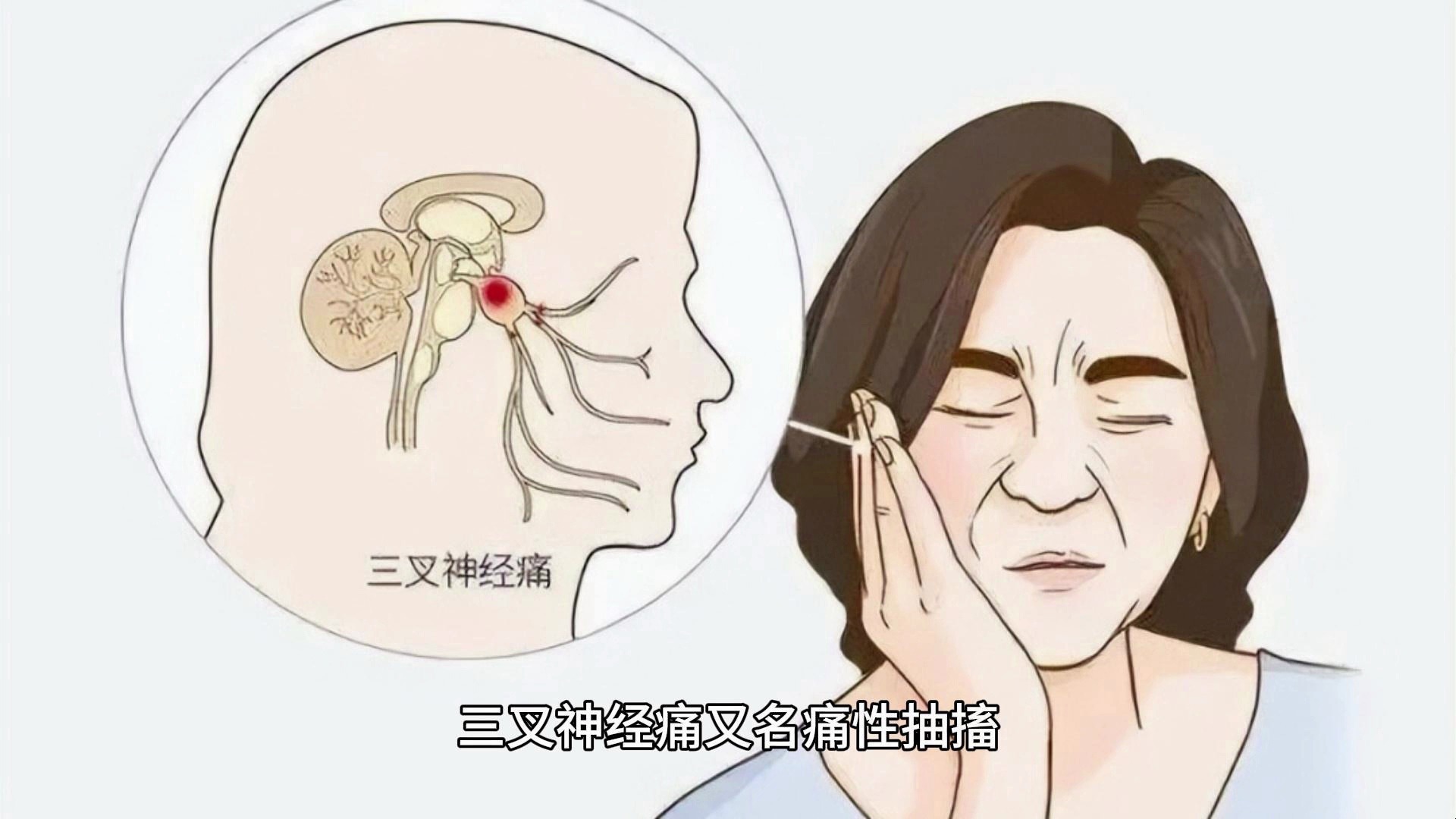 长沙有看三叉神经痛的医院吗