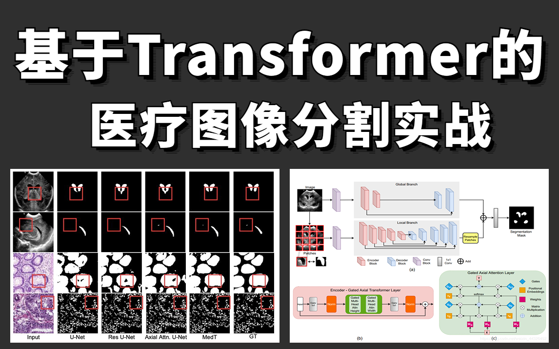 Transformer一脚踹进图像分割领域:基于Medical Transformer的医疗图像分割实战教程,论文解读+源码复现!哔哩哔哩bilibili