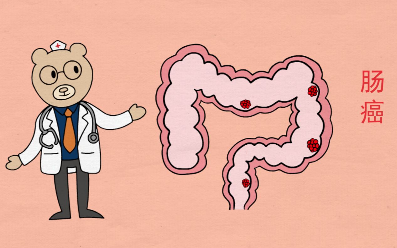 结肠癌卡通图片图片
