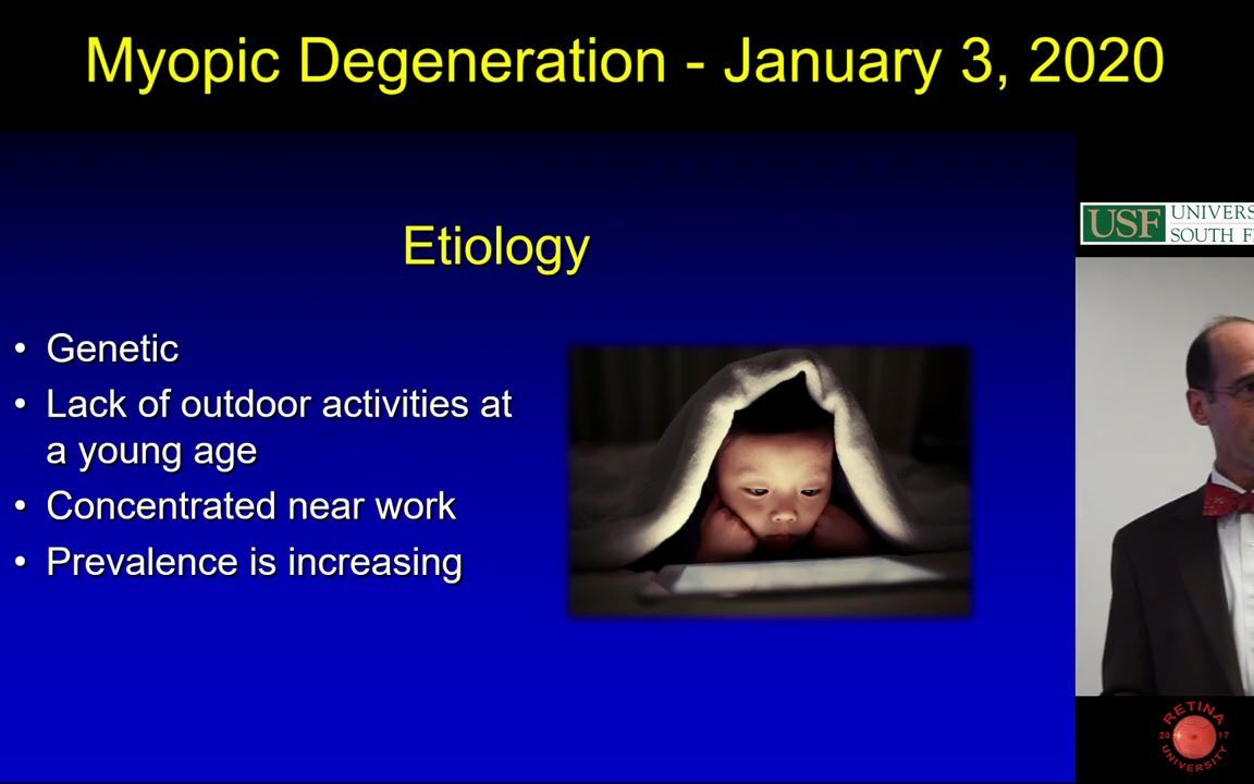 Myopic Degeneration  高度近视性眼底病变哔哩哔哩bilibili