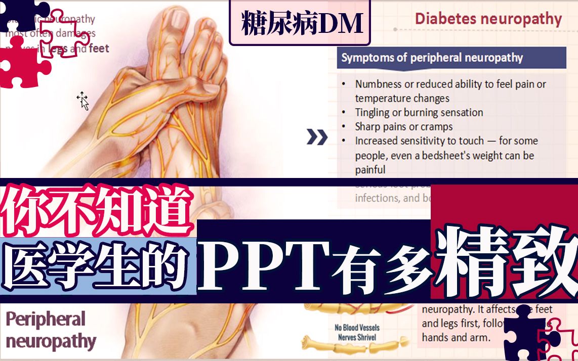 【医学生】(50秒资料分享)你不知道医学生PPT有多精致, 中英糖尿病DIABETES MELLITUS,想要糖尿病资料的小伙伴私信我,记得三连鼓励,谢谢.哔...