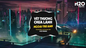 TOP 30 NHẠC REMIX TREND TIKTOK 2024- Vừa Hận Vừa Yêu, Vở Kịch Của Em, Ngoại Trừ