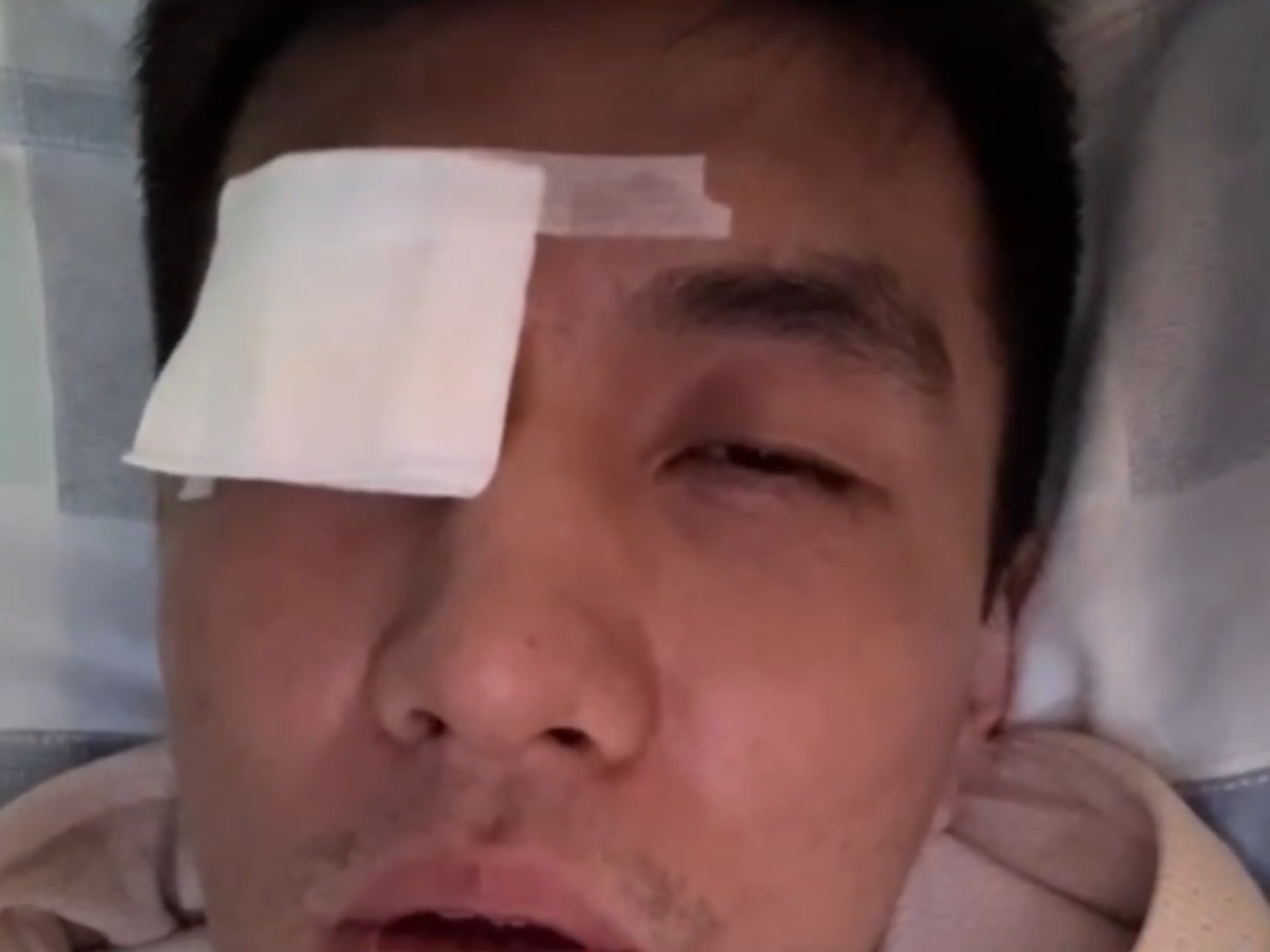 郭艾伦眼睛受伤#郭艾伦眼睛受伤 #郭艾伦