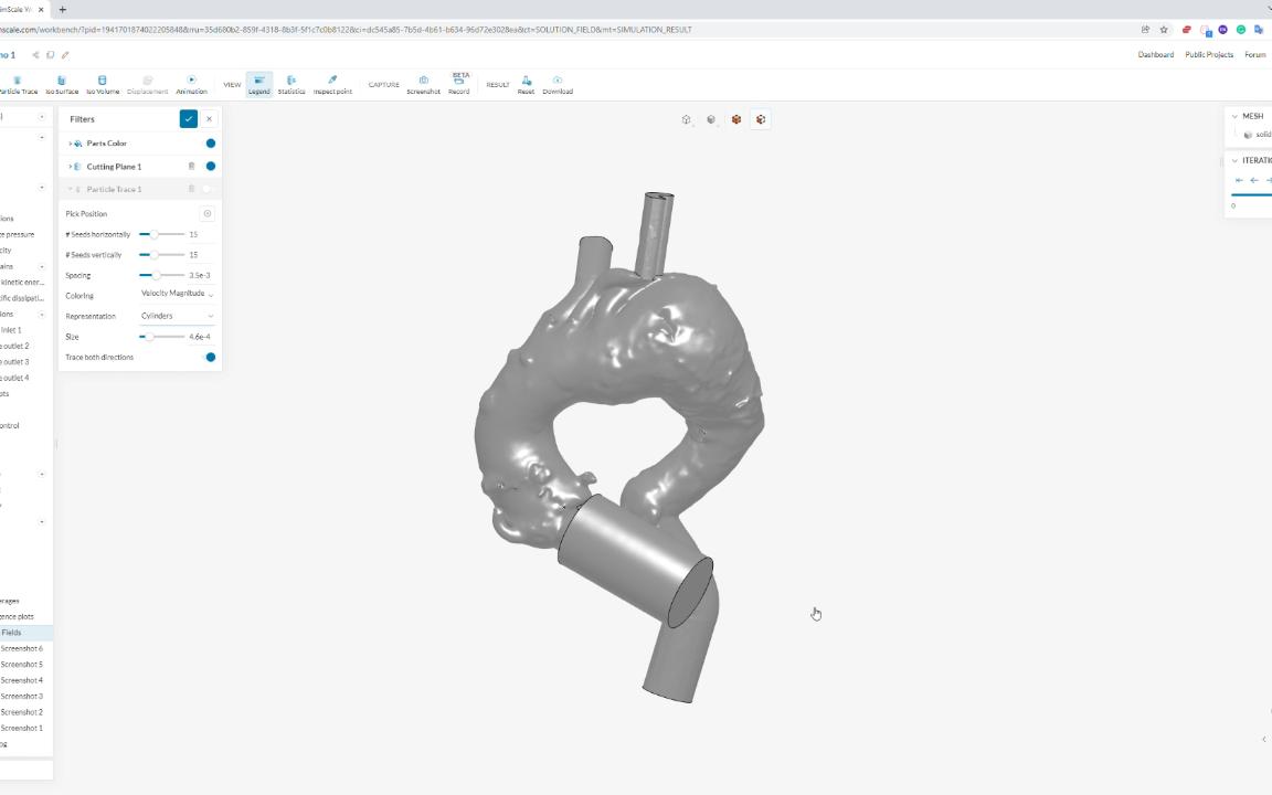 《SimScale 初体验系列》 Aortic Test Demo 1哔哩哔哩bilibili