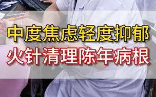 下载视频: 中度焦虑轻度抑郁 火针清理陈年病根