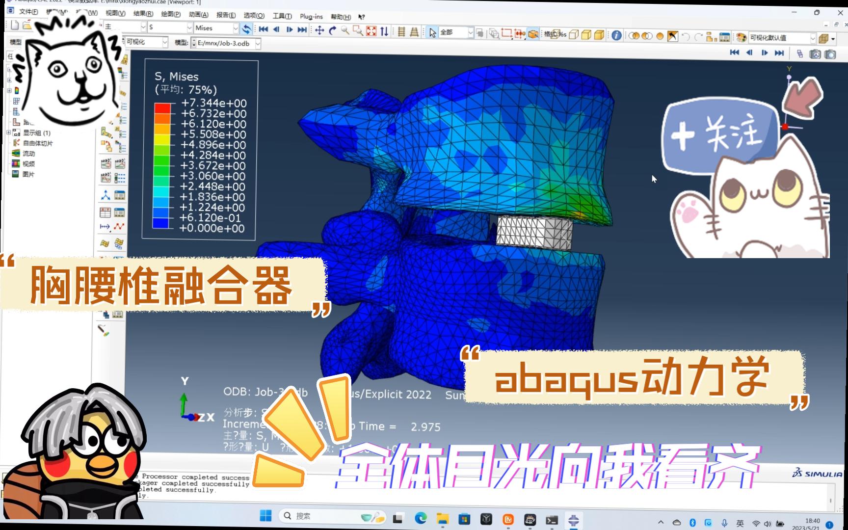 硬核!abaqus胸腰椎融合器动力学有限元分析(融合器打入锥体运动仿真)(医疗器械相关)哔哩哔哩bilibili