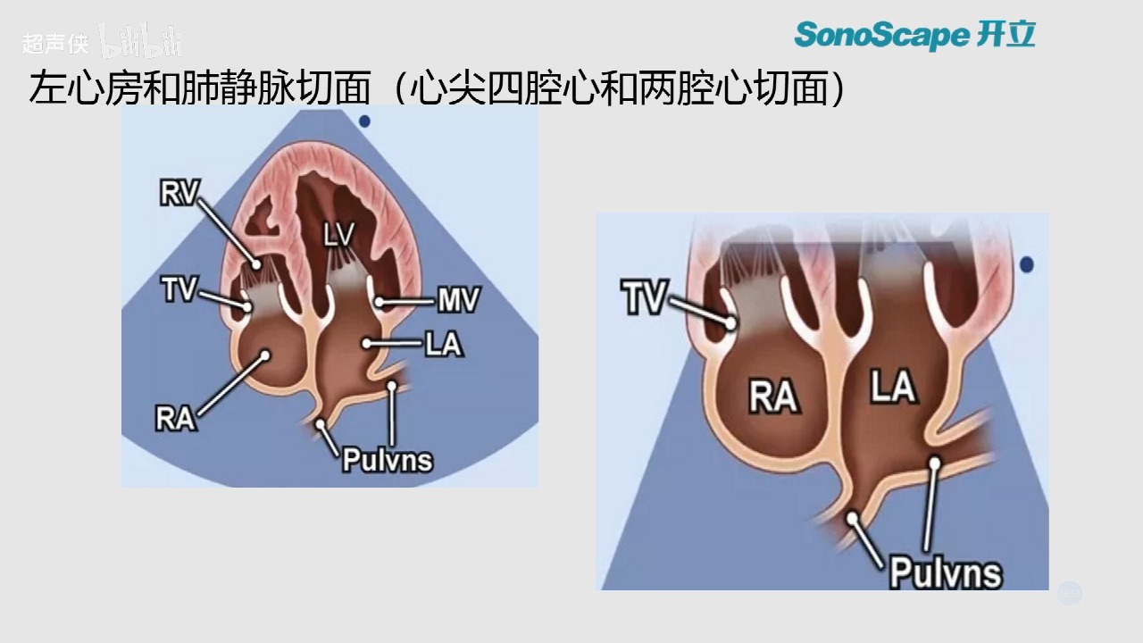 心脏超声八个标准切面图片