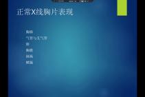 胸部平片的影像判读方法及常见疾病的影像表现(上)哔哩哔哩bilibili