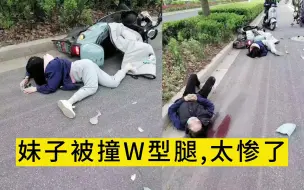 Download Video: 挖槽，妹子这一撞，当场成W形状痛苦不已，太惨了