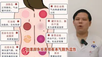 Download Video: 正确拔火罐，拔出健康来