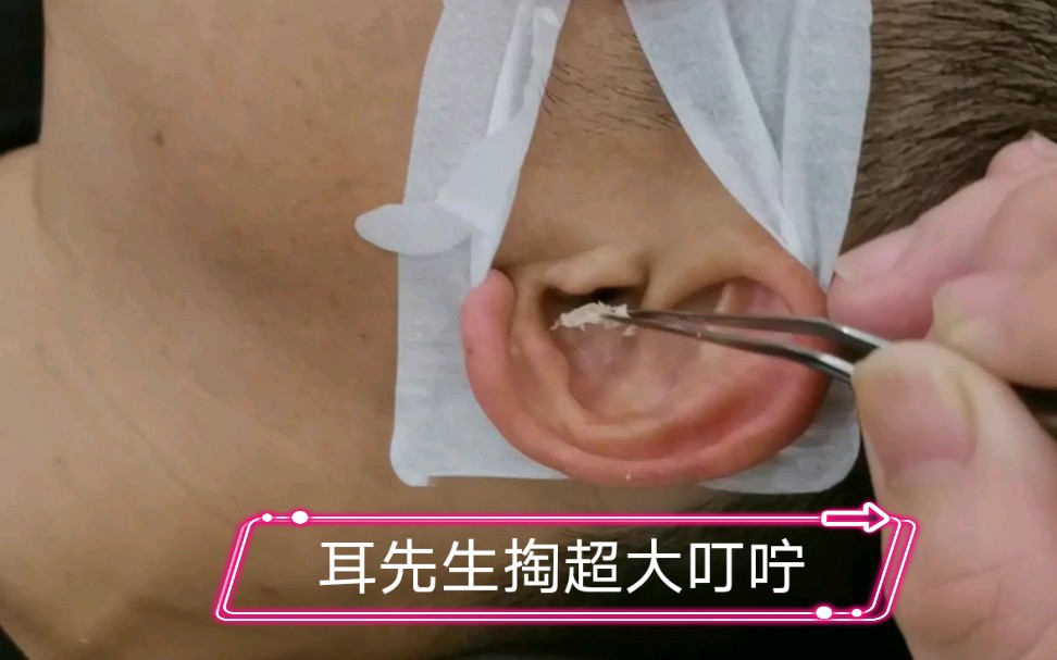 大家好我是一名90后男采耳师傅感谢大家支持