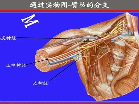 厦门医学院《人体解剖学》教学视频课174集147.臂丛哔哩哔哩bilibili